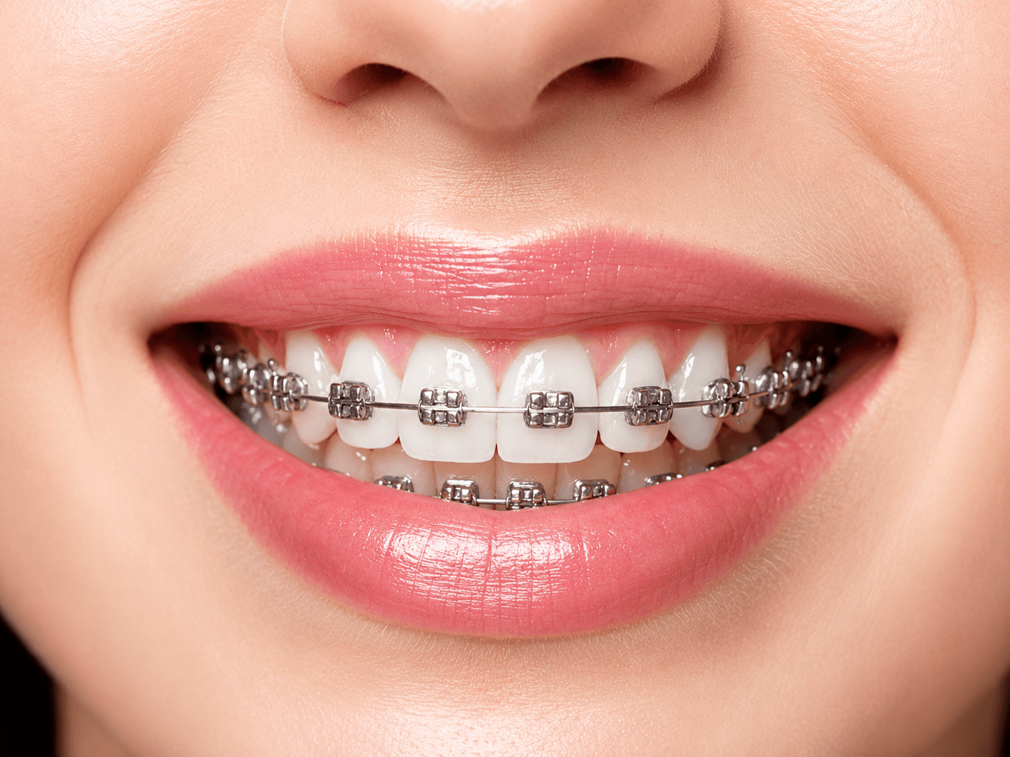 Orthodontics