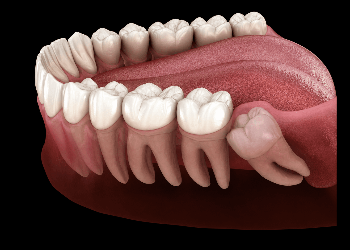 Oral Surgery